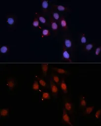 Anti-SMAD5 antibody used in Immunocytochemistry/ Immunofluorescence (ICC/IF). GTX32881