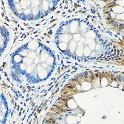 Anti-SMAD5 antibody used in IHC (Paraffin sections) (IHC-P). GTX32881
