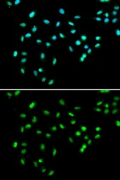 Anti-SMARCAD1 antibody used in Immunocytochemistry/ Immunofluorescence (ICC/IF). GTX32882