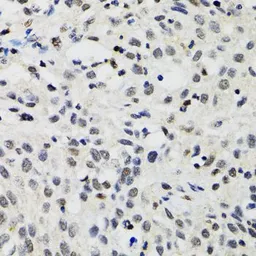 Anti-SMARCAD1 antibody used in IHC (Paraffin sections) (IHC-P). GTX32882