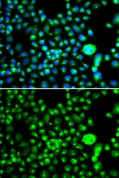 Anti-SMCHD1 antibody used in Immunocytochemistry/ Immunofluorescence (ICC/IF). GTX32883