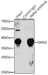 Anti-SMN2 antibody used in Immunoprecipitation (IP). GTX32884