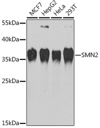 Anti-SMN2 antibody used in Western Blot (WB). GTX32884