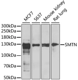 Anti-Smoothelin antibody used in Western Blot (WB). GTX32885