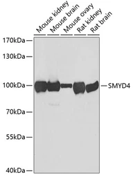 Anti-SMYD4 antibody used in Western Blot (WB). GTX32886