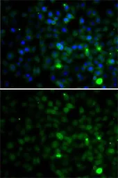 Anti-SMYD4 antibody used in Immunocytochemistry/ Immunofluorescence (ICC/IF). GTX32886