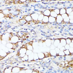Anti-SMYD4 antibody used in IHC (Paraffin sections) (IHC-P). GTX32886