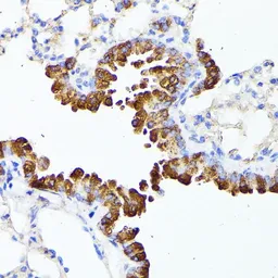 Anti-SMYD4 antibody used in IHC (Paraffin sections) (IHC-P). GTX32886
