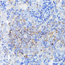 Anti-SMYD4 antibody used in IHC (Paraffin sections) (IHC-P). GTX32886