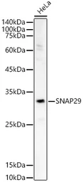 Anti-SNAP29 antibody used in Western Blot (WB). GTX32887
