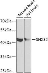 Anti-SNX32 antibody used in Western Blot (WB). GTX32889