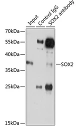 Anti-SOX2 antibody used in Immunoprecipitation (IP). GTX32891