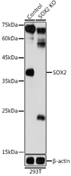 Anti-SOX2 antibody used in Western Blot (WB). GTX32891