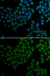 Anti-SOX2 antibody used in Immunocytochemistry/ Immunofluorescence (ICC/IF). GTX32891