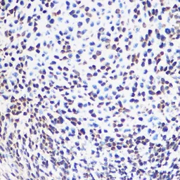 Anti-SOX2 antibody used in IHC (Paraffin sections) (IHC-P). GTX32891