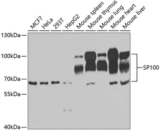 Anti-SP100 antibody used in Western Blot (WB). GTX32892