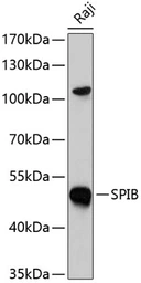 Anti-SPIB antibody used in Western Blot (WB). GTX32893