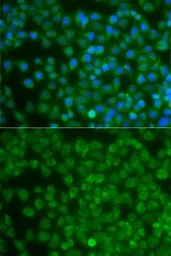 Anti-SPIB antibody used in Immunocytochemistry/ Immunofluorescence (ICC/IF). GTX32893