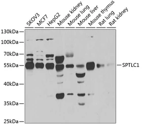 Anti-SPTLC1 antibody used in Western Blot (WB). GTX32895