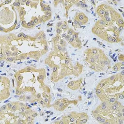 Anti-SPTLC1 antibody used in IHC (Paraffin sections) (IHC-P). GTX32895