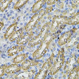 Anti-SPTLC1 antibody used in IHC (Paraffin sections) (IHC-P). GTX32895