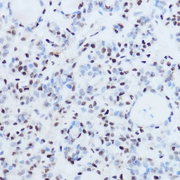 Anti-SSB antibody used in Immunoprecipitation (IP). GTX32896