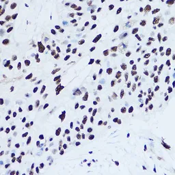 Anti-SSB antibody used in Immunocytochemistry/ Immunofluorescence (ICC/IF). GTX32896