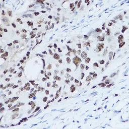 Anti-SSB antibody used in IHC (Paraffin sections) (IHC-P). GTX32896