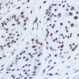 Anti-SSB antibody used in IHC (Paraffin sections) (IHC-P). GTX32896