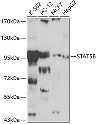 Anti-STAT5B antibody used in Western Blot (WB). GTX32898