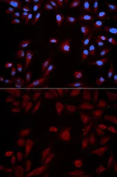 Anti-STAT5B antibody used in Immunocytochemistry/ Immunofluorescence (ICC/IF). GTX32898