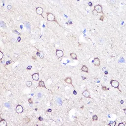 Anti-Stathmin 1 antibody used in IHC (Paraffin sections) (IHC-P). GTX32899