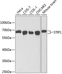 Anti-STIP1 antibody used in Western Blot (WB). GTX32900