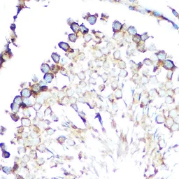Anti-STIP1 antibody used in IHC (Paraffin sections) (IHC-P). GTX32900