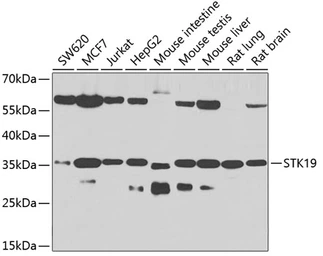 Anti-STK19 antibody used in Western Blot (WB). GTX32901