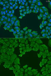 Anti-STXBP3 antibody used in Immunocytochemistry/ Immunofluorescence (ICC/IF). GTX32903