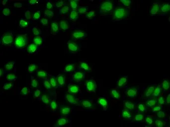 Anti-SULT2B1 antibody used in Immunocytochemistry/ Immunofluorescence (ICC/IF). GTX32904