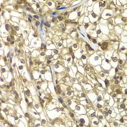 Anti-SULT2B1 antibody used in IHC (Paraffin sections) (IHC-P). GTX32904
