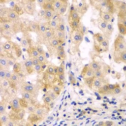 Anti-SULT2B1 antibody used in IHC (Paraffin sections) (IHC-P). GTX32904