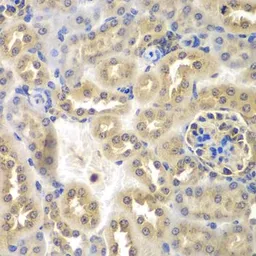 Anti-SULT2B1 antibody used in IHC (Paraffin sections) (IHC-P). GTX32904