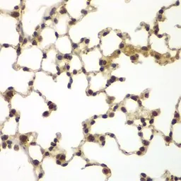 Anti-SULT2B1 antibody used in IHC (Paraffin sections) (IHC-P). GTX32904