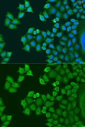 Anti-SYT4 antibody used in Immunocytochemistry/ Immunofluorescence (ICC/IF). GTX32906