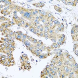 Anti-SYT4 antibody used in IHC (Paraffin sections) (IHC-P). GTX32906