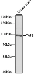 Anti-TAF5 antibody used in Western Blot (WB). GTX32908
