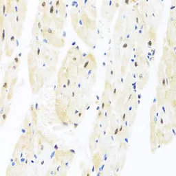 Anti-TAF9 antibody used in IHC (Paraffin sections) (IHC-P). GTX32909