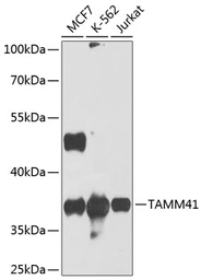 Anti-TAMM41 antibody used in Western Blot (WB). GTX32910