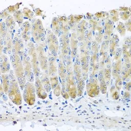 Anti-TAMM41 antibody used in IHC (Paraffin sections) (IHC-P). GTX32910