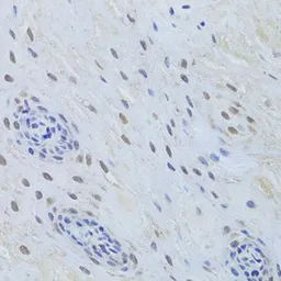 Anti-TDP43 antibody used in IHC (Paraffin sections) (IHC-P). GTX32912