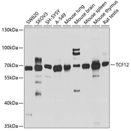 Anti-TCF12 antibody used in Western Blot (WB). GTX32914