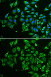 Anti-Tetranectin antibody used in Immunocytochemistry/ Immunofluorescence (ICC/IF). GTX32919